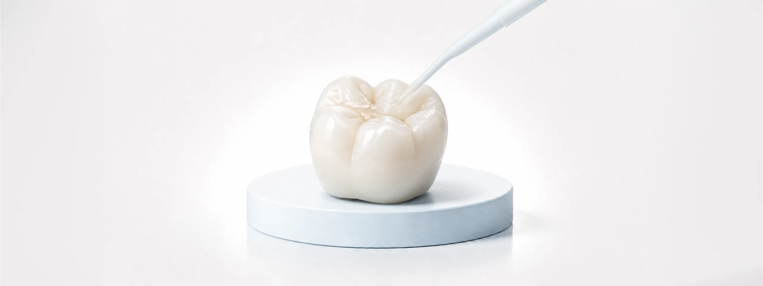Tooth-Coloured Fillings